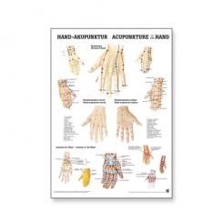 Poster Hand Akupunktur 
