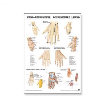 Poster Hand Akupunktur 